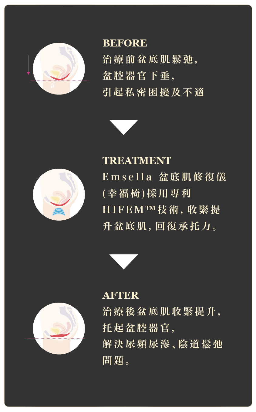 鬆弛素_工作區域 1 複本 18