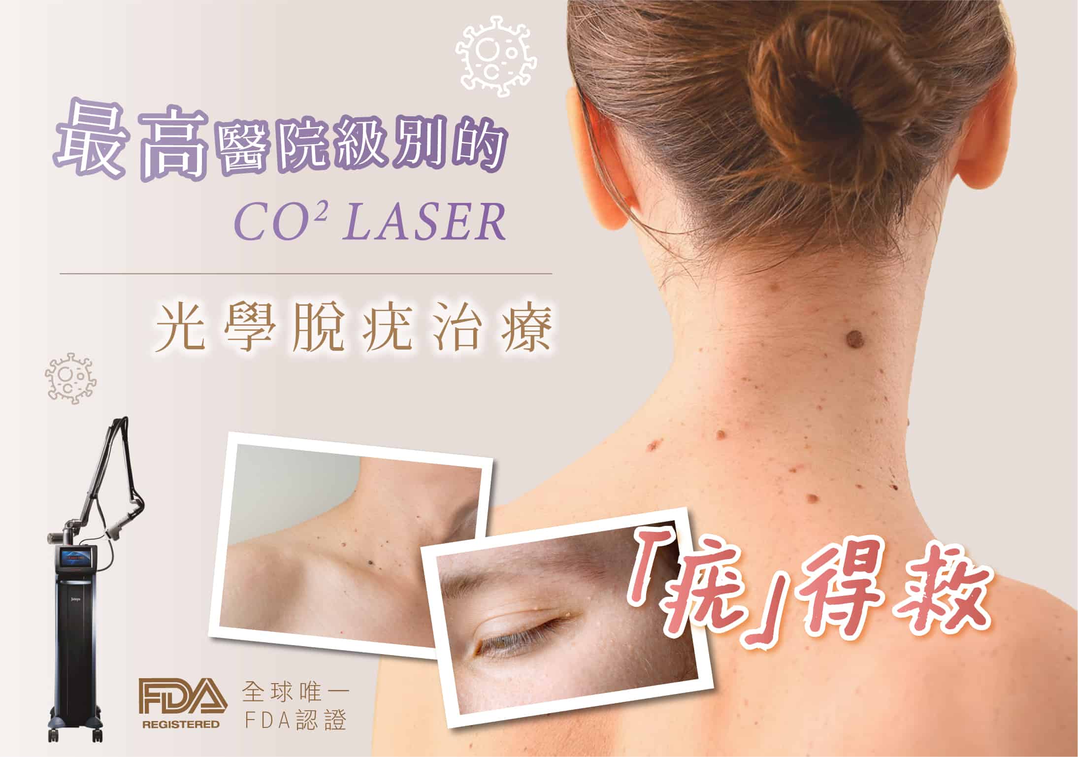 Co2_laser