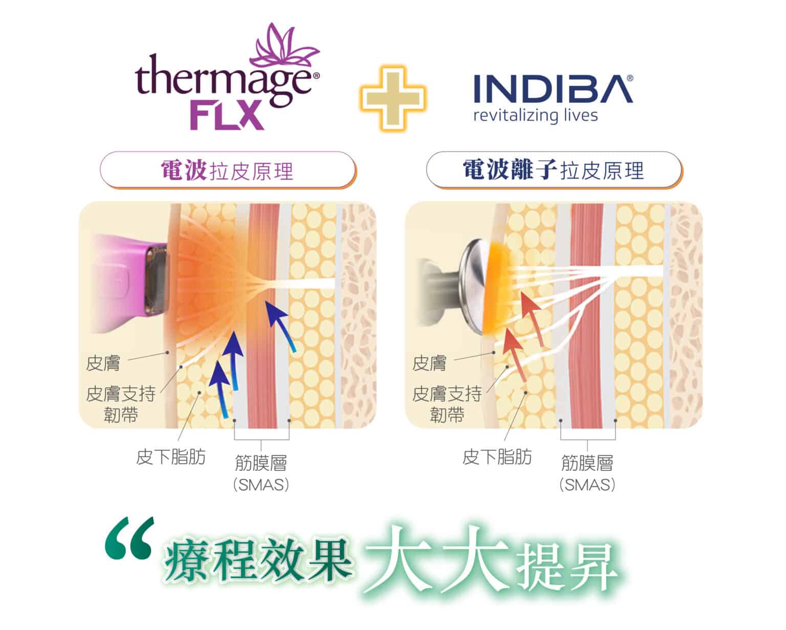 Thermage_new